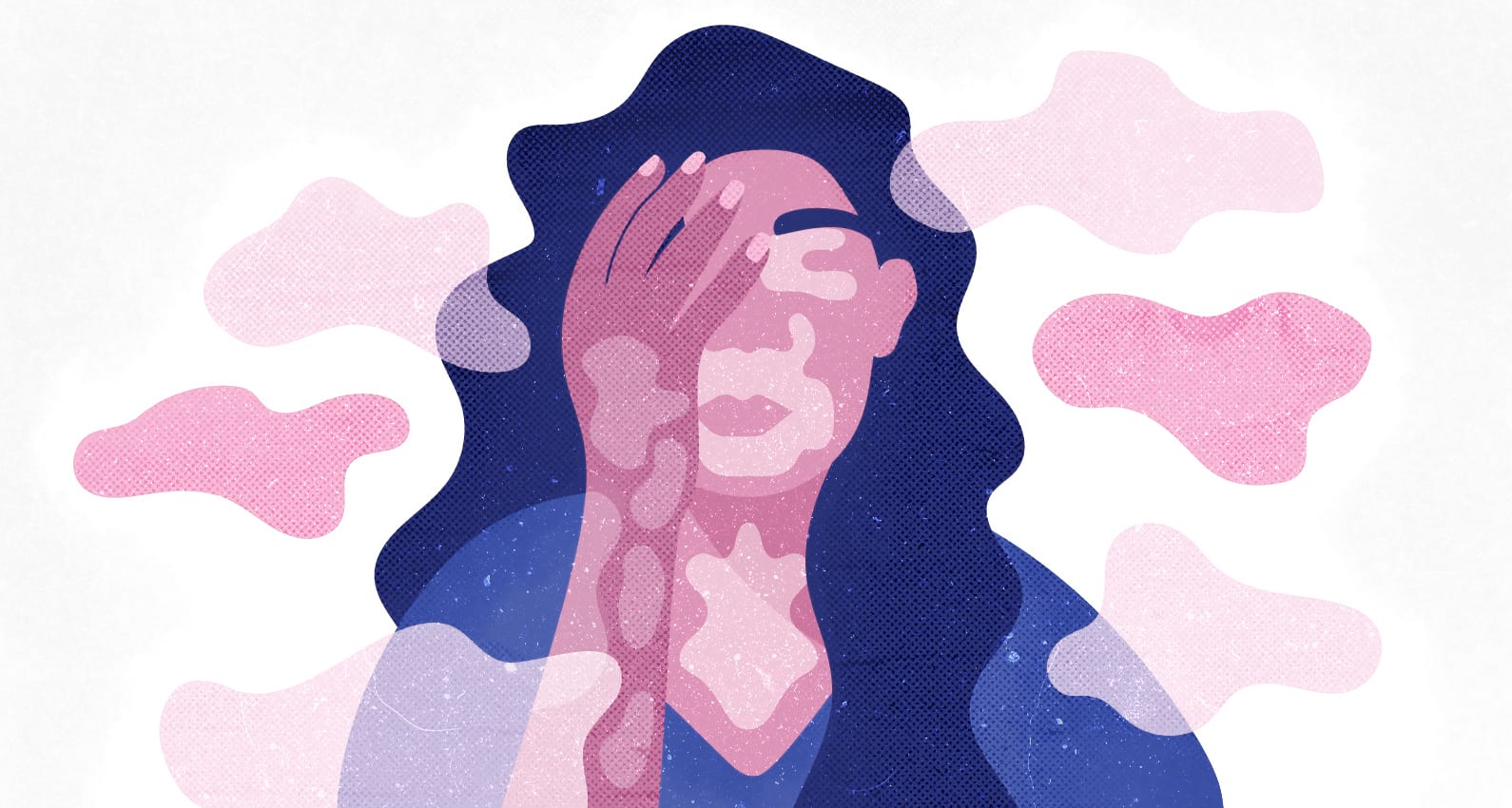 theswaddle-vitiligo-website-shreyaakrritikadas-1.jpeg